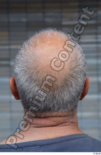 Street  650 bald hair head 0001.jpg